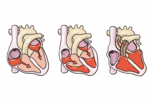 fases-corazon_thumb_e