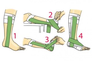 vendaje-tobillo_thumb_e